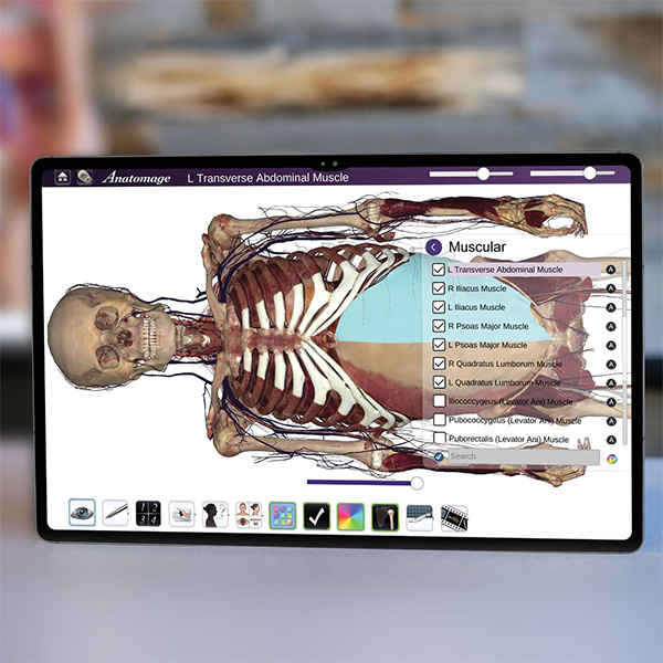 Image of tablet